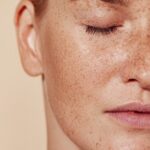 Pigmentation Treatment in Dubai: Before and After Results You’ll Love