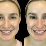 Inside the Best Aesthetic Clinic in Dubai: Technology, Expertise, and Results